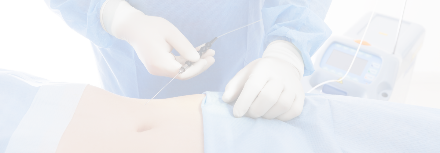 Renuvion Handpieces